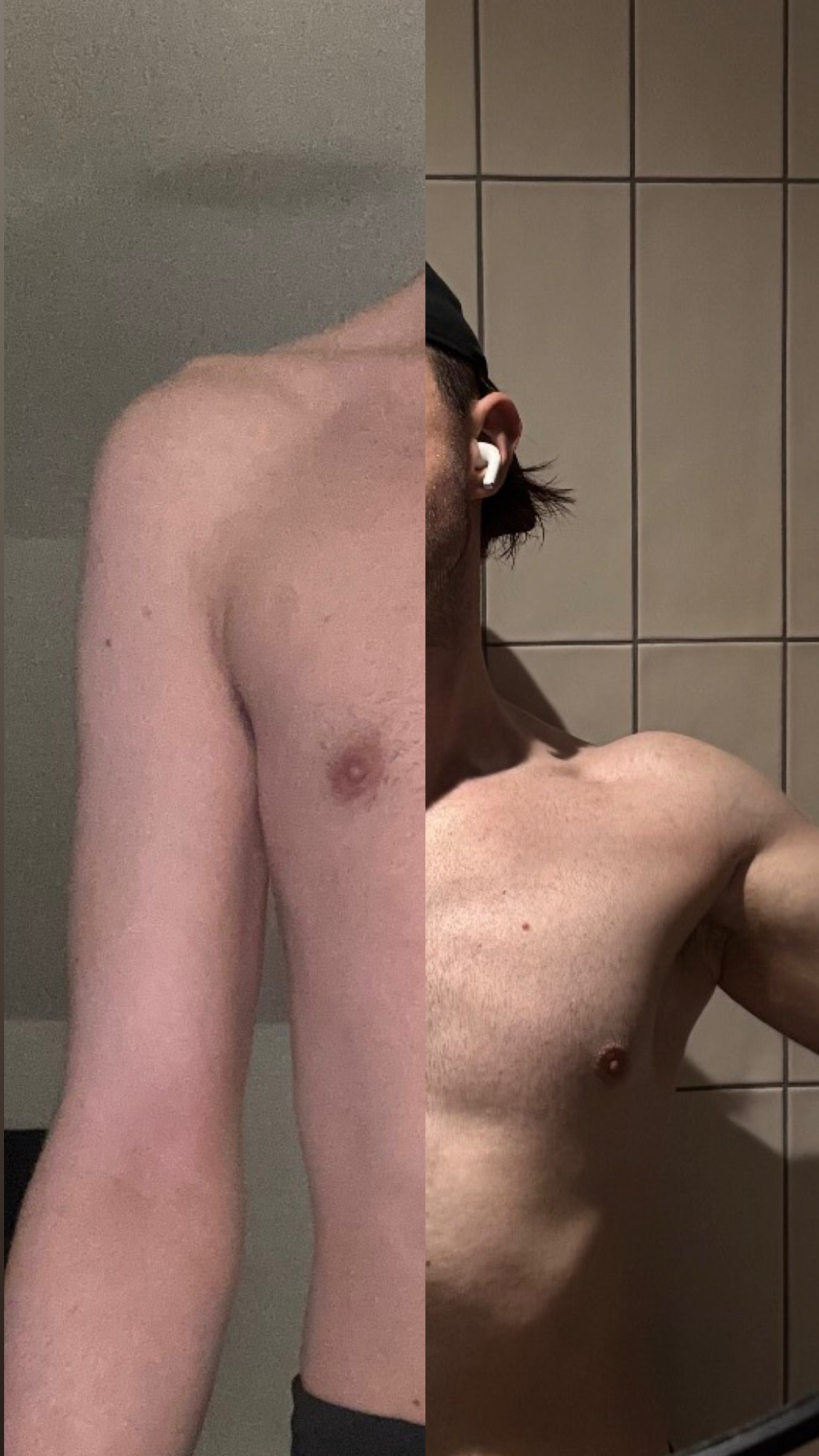 Before and after shoulder and chest transformation