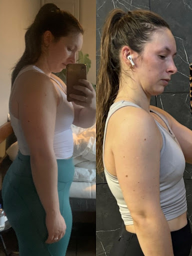 Before and after side profile weight-loss transformation