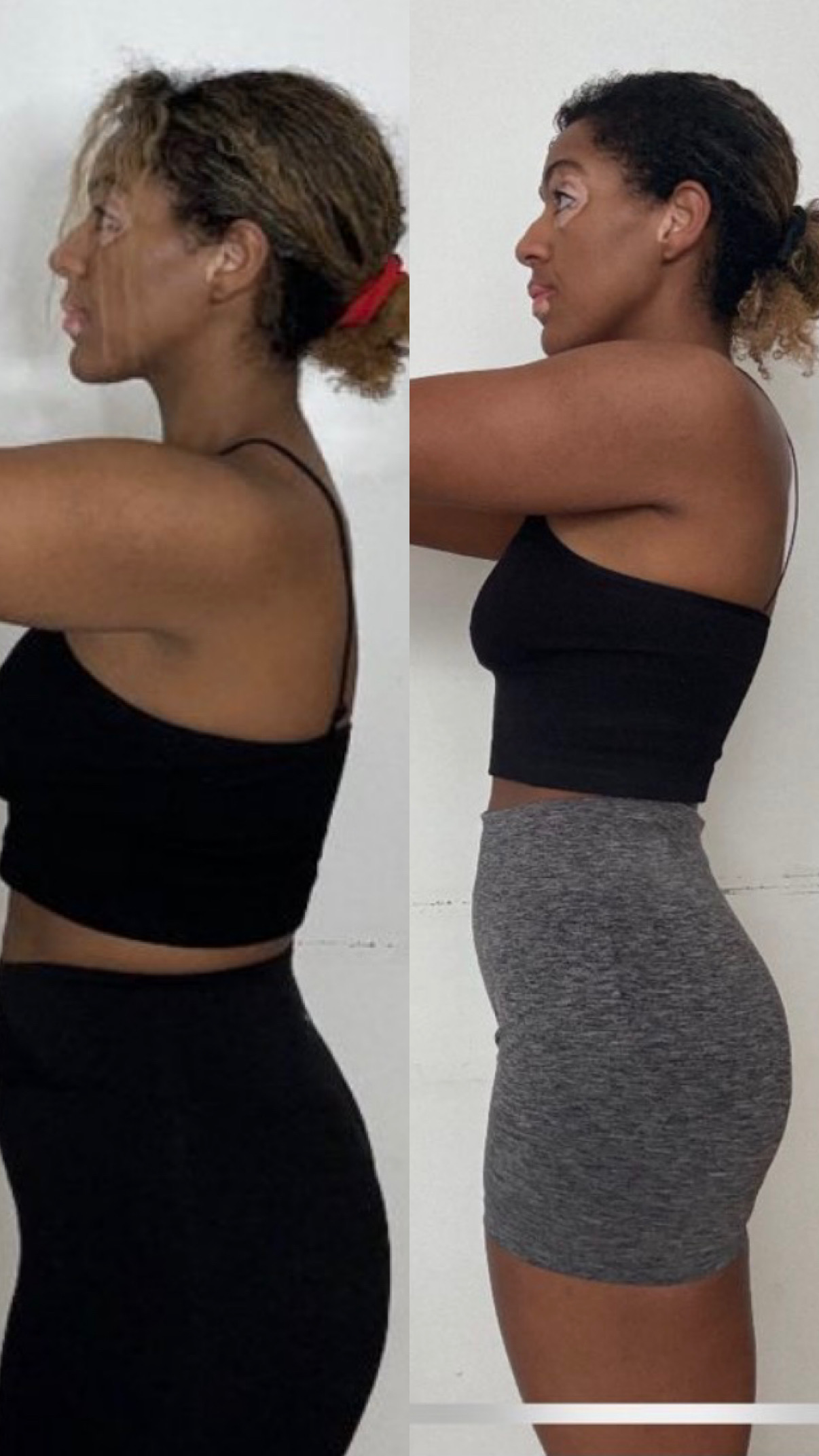 Yasmin before and after side profile transformation
