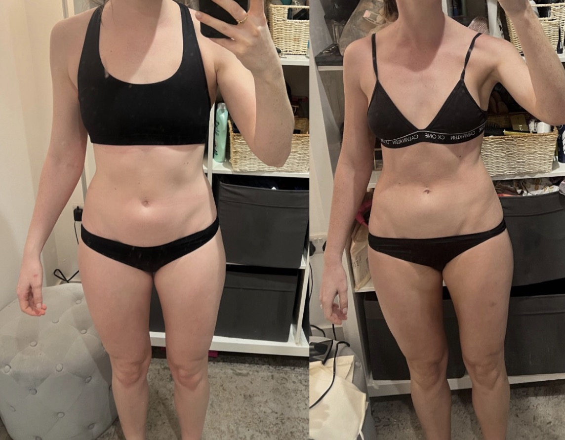 Kerrie before and after weight-loss transformation