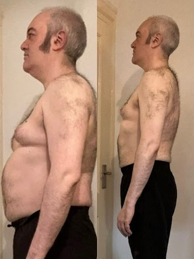 Before and after belly fat-loss side transformation