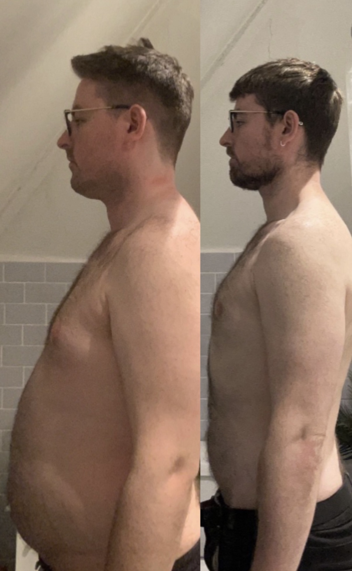 Before and after side profile weight-loss transformation