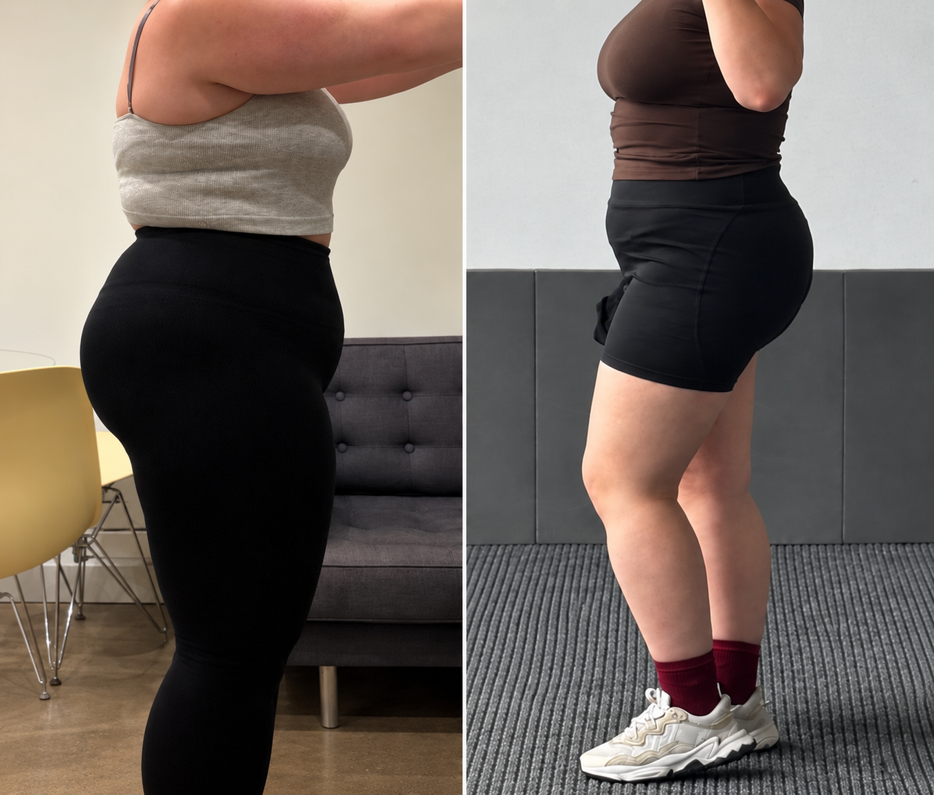 Bethan before and after weight-loss transformation